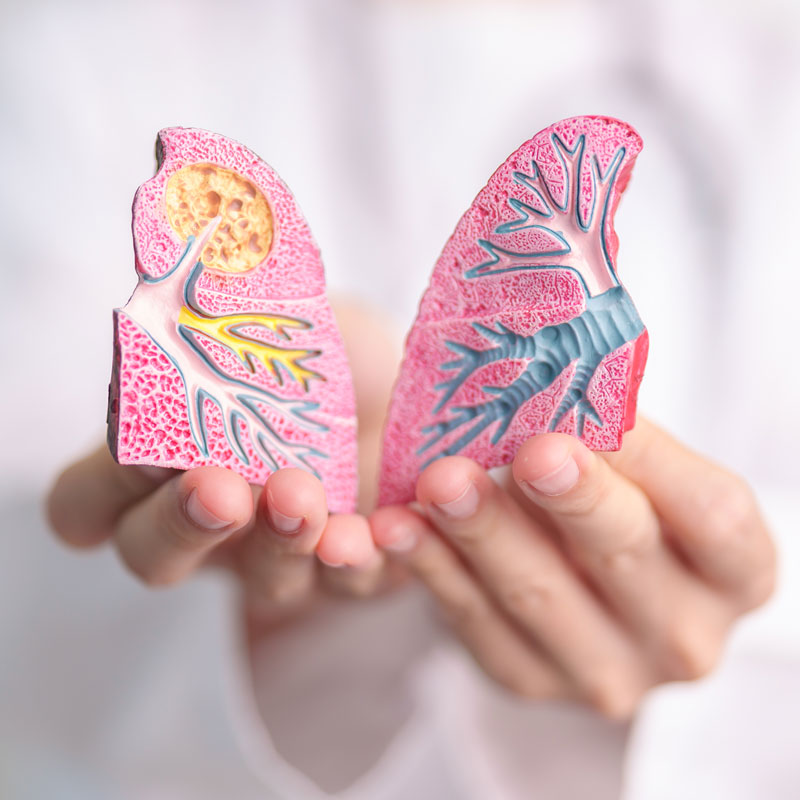A detailed anatomical model of human lungs, showcasing bronchial structures and pulmonary details; the left lung shows a healthy one, while the right lung depicts an obstructed lung.