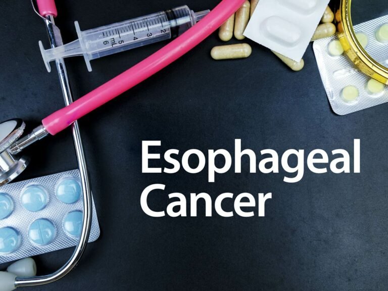 Esophageal Cancer Essentials: A photo montage featuring a stethoscope, pill packets, syringe, and the words 'Esophageal Cancer' - comprehensive care.